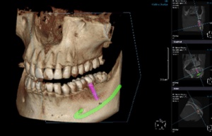 Bezpieczna diagnostyka z Esdent Dental Equipment