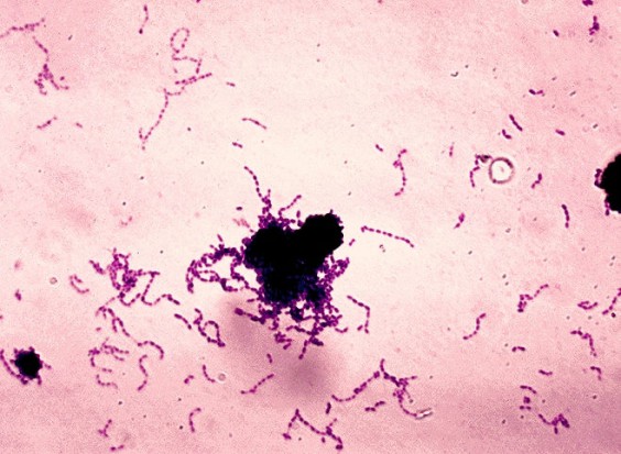Probiotyki radzą sobie z Streptococcus mutans (na zdjęciu, źródło: wikipedia.org) Probiotyki pomagają pacjentom z rozszczepem wargi i podniebienia