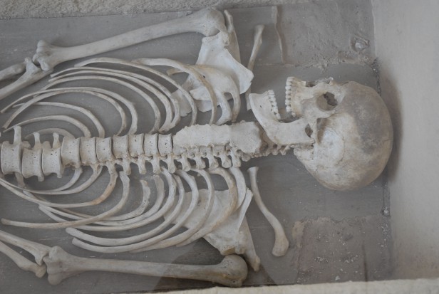 Bydgoska wystawa może być ciekawym źródłem wiedzy również dla dentystów (fot. sxc.hu) Dziecko z wrodzoną kiłą – historyczna żuchwa prawdę powie