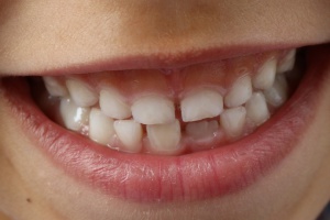 Stomatologia dziecięca (foto: pixabay) Ilu dentystów leczy dzieci