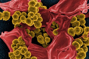 Łatwiej będzie leczyć infekcje bakteryjne dzięki dzięki aparatowi BacterOMIC AST (fot. pixabay) Naukowcy opracowali szybką i dokładną metodę oceny lekooporności bakterii