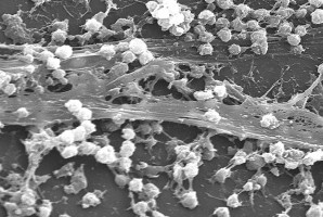 Biofilm wytworzony przez gronkowca złocistego (źródło: Wikipedia) Co skuteczne w walce z biofilmem