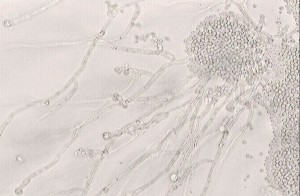 Candida albicans przyczynia się do rozwoju próchnicy szczególnie u osób jedzących dużo słodkich pokarmów (fot. Wikipedia) Naukowcy: otwórzmy drugi front walki z próchnicą