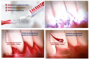 Lacalut Aktiv na cenzurowanym Reklama Lacalut Aktiv narusza Kodeks Etyki Reklamy