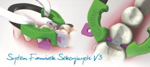 LAUREACI GRAND PRIX CEDE 2012 - skuteczna i przyjazna odbudowa anatomicznych punktów stycznych
