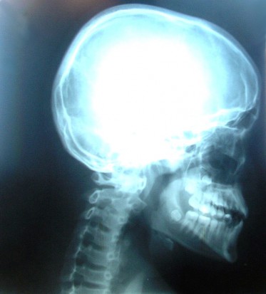 Uprawnienia inspektora ochrony radiologicznej bez szkolenia, ale..(foto: sxc.hu) Uprawnienia inspektora ochrony radiologicznej bez szkolenia, ale..(foto: sxc.hu)