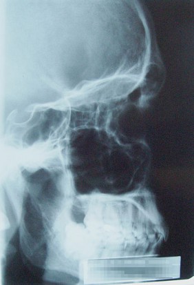 Twój rentgen pod czujnym okiem, ale czyim? (źródło: Wikipedia)