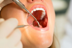 Zapalenie w jamie ustnej winne wielu chorób
