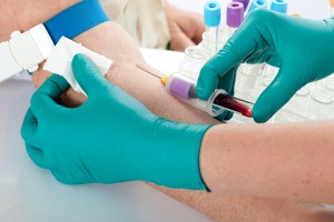 Testy na HIV w gabinecie stomatologa. USA daje przykład, co z Polską?