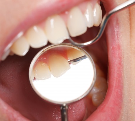 Zęby z moczu? (fot. Fotolia)