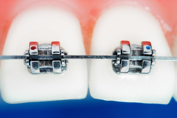Elektroniczny ząb wykryje złe nawyki (fot. Fotolia)