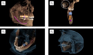 Sirona Galileos 3D: twarzoczaszka „od podszewki