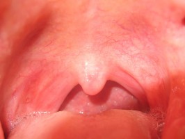 ADA: lekarz dentysta może pomóc w diagnozie cukrzycy