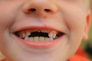 Lekarze dentyści odpowiedzą za niezrealizowanie niemożliwych do zrealizowania programów?