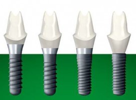 Straumann obniża ceny niektórych implantów