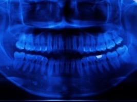 Szkolenia dentystów z ochrony radiologicznej pacjenta