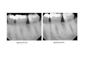 Gendex Expert DC - ekspert w radiografii