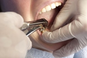 Kontraktowanie: jeden dentysta, kilka specjalizacji i tylko jeden etat