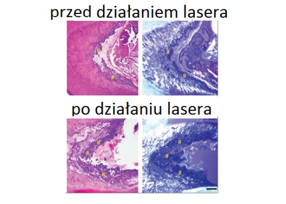 Komórki macierzyste, stymulowane promieniem lasera, Komórki macierzyste, stymulowane promieniem lasera,