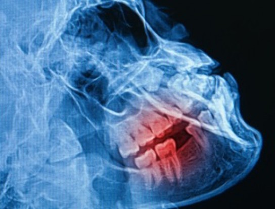 Co znaczy, że dentysta zapewnia aparat RTG (foto: freedigitalphotos) Co znaczy, że dentysta zapewnia aparat RTG