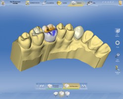 Software CEREC jeszcze lepszy