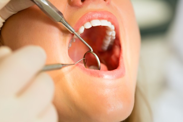 Portfolio Kerr powiększa się o produkty Dux Dental (fot. Dux Dental) Portfolio Kerr powiększone o produkty Dux Dental