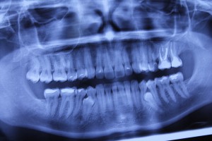 Dentyści apelują o nowelizację przepisów radiologicznych