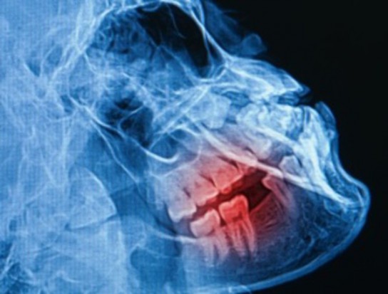 Opinia prof. Jerzego Waleckiego może być kluczowa w walce o ułatwienie przepisów z zakresu radiologii stomatologicznej (fot. Fotolia/PTWP) Ułatwienia w radiologii – konkretne pomysły
