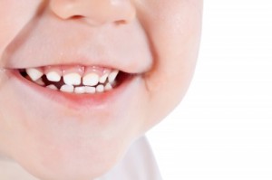 Medicover: profilaktyka jamy ustnej u dzieci 