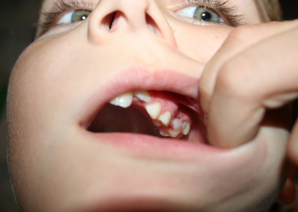 Jabłonna czeka na dentystę (foto: sxchu) Jak nie należy organizować konkursu na usługi stomatologiczne