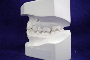 Technik dentystyczny w zasadzie nie pracuje w szczególnych warunkach