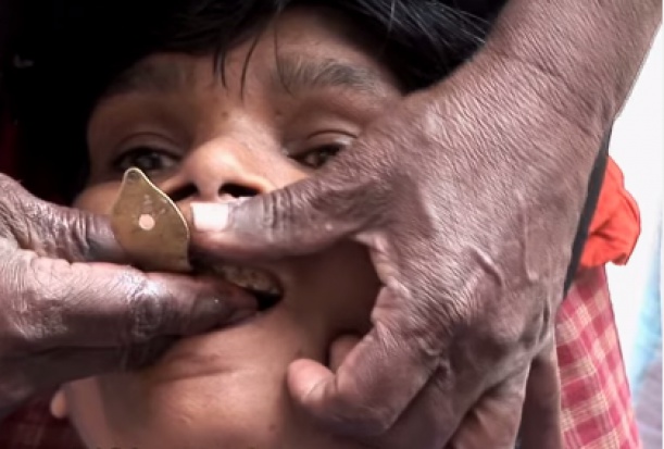 Uliczny dentysta w Indiach Klinika na krawężniku chodnika w Bangalore