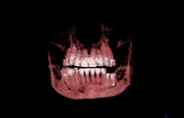 CBCT w stomatologii (foto: wikimedia) Tak dla CBCT podczas Academy of General Dentistry