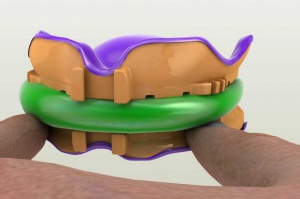 Podbudowy koron z drukarki 3D FDA aprobuje podbudowy koron z drukarek 3D