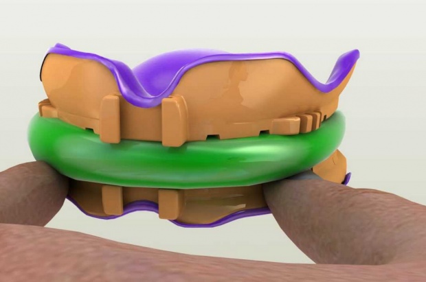Podbudowy koron z drukarki 3D FDA aprobuje podbudowy koron z drukarek 3D