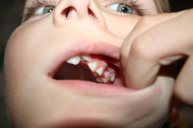 dental.jpg PES ze stomatologii dziecięcej: w zasadzie pogrom