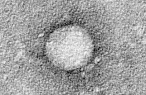 HCV (foto: wikimedia) HCV krąży wokół gabinetów dentystycznych