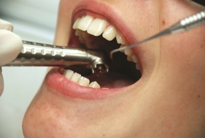 Laser w gabinecie stomatologicznym: od uprzedzenia do pasji