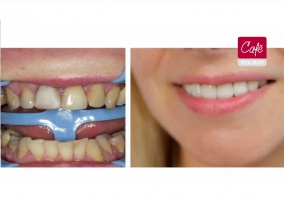 Dentyści reklamują swoje usługi w "Fabryce Piękna" Co robią dentyści w