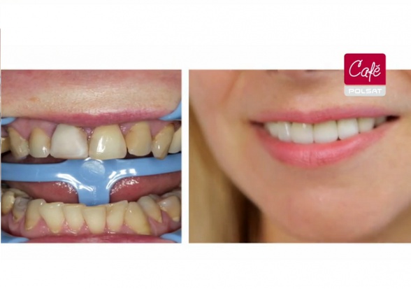 Dentyści reklamują swoje usługi w Co robią dentyści w