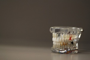 Osiągnięcie polksich chirurgów (foto: pixabay) Żuchwa 3D ratuje chłopcu twarz przed deformacją