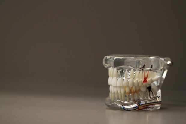 Osiągnięcie polksich chirurgów (foto: pixabay) Żuchwa 3D ratuje chłopcu twarz przed deformacją