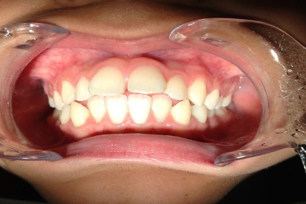 Kształcenie specjalizacyjne lekarzy dentystów w kryzysie (foto: pixabay) Kształcenie specjalizacyjne lekarzy dentystów w kryzysie, co robić?