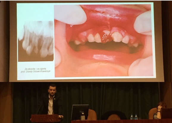 Maciej Michalak podczas IX Ogólnopolskiej konferencji „Ostrożnie - dziecko! Profilaktyka krzywdzenia małych dzieci” IX konferencja: Profilaktyka krzywdzenia małych dzieci - znacząca rola także dentystów