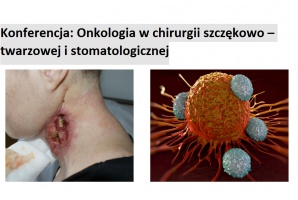 Onkologia w chirurgii szczękowo – twarzowej i stomatologicznej Onkologia w chirurgii szczękowo – twarzowej i stomatologicznej