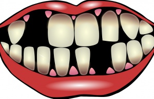Sztuczne zęby z modeliny, gdy nie stać na dentystę (fot. pixabay) Robię gustowne protezy z modeliny (od ręki)