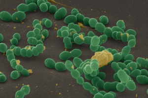 Streptococcus mutans - główny sprawca próchnicy Próchnica: jak bakterie krążą w rodzinie