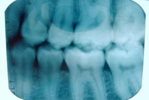 Wypełnianie kart aparatów RTG nie należy do dentysty (foto: sxc.hu) Ktoś chce zarobić na bazie Sanepidu z urządzeniami RTG