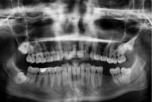 Kursy z zakresu ochrony radiologicznej pacjenta (foto: pixabay) Komu potrzebny certyfikat z zakresu ochrony radiologicznej