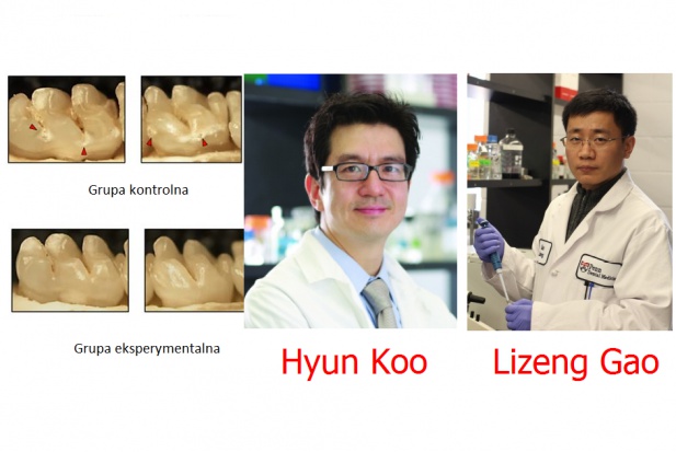 Eksperymenty z nanocząsteczkami atakującymi próchnicę Nadtlenek wodoru z nanocząsteczkami atakuje próchnicę